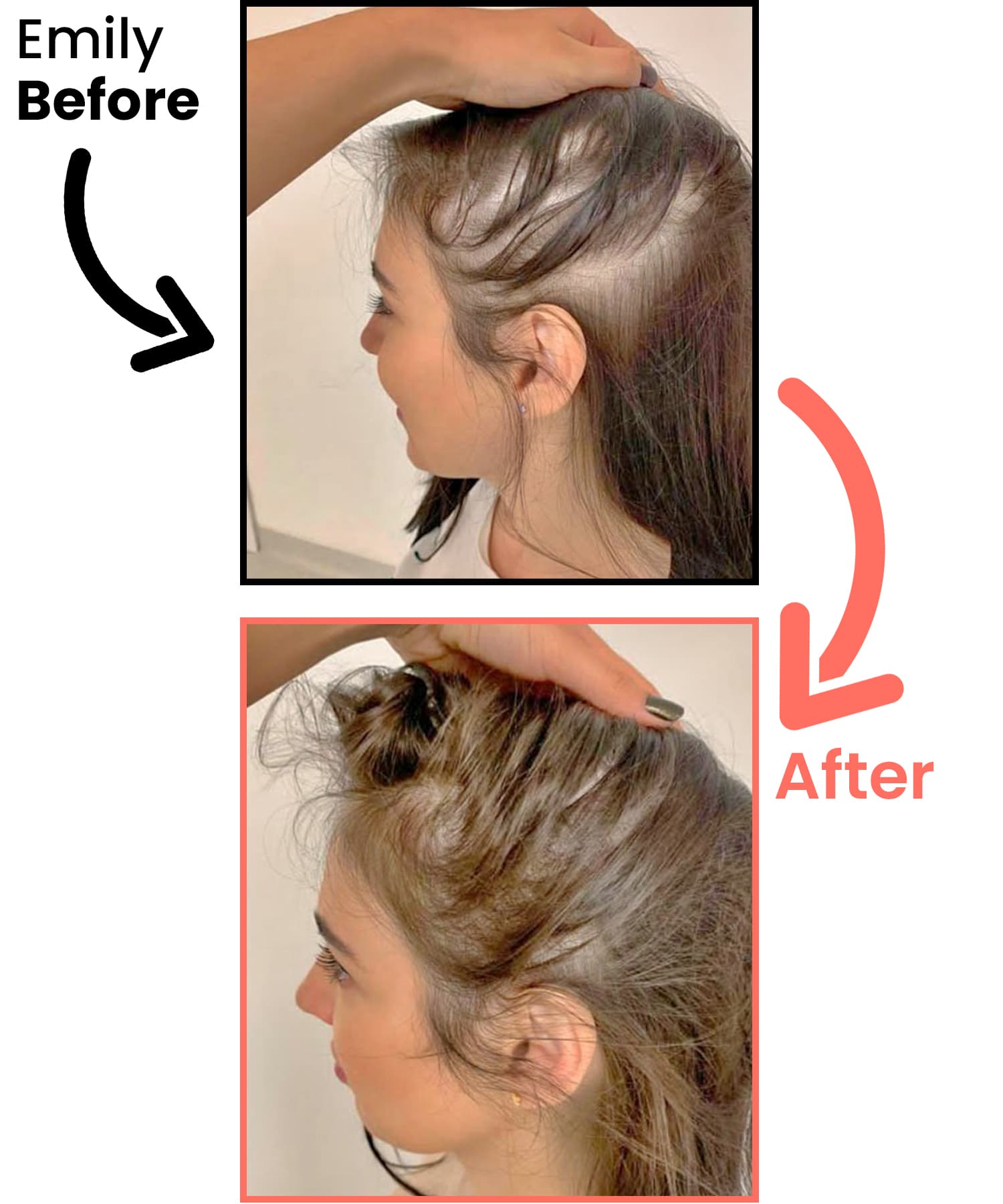 before-after-neu-emily