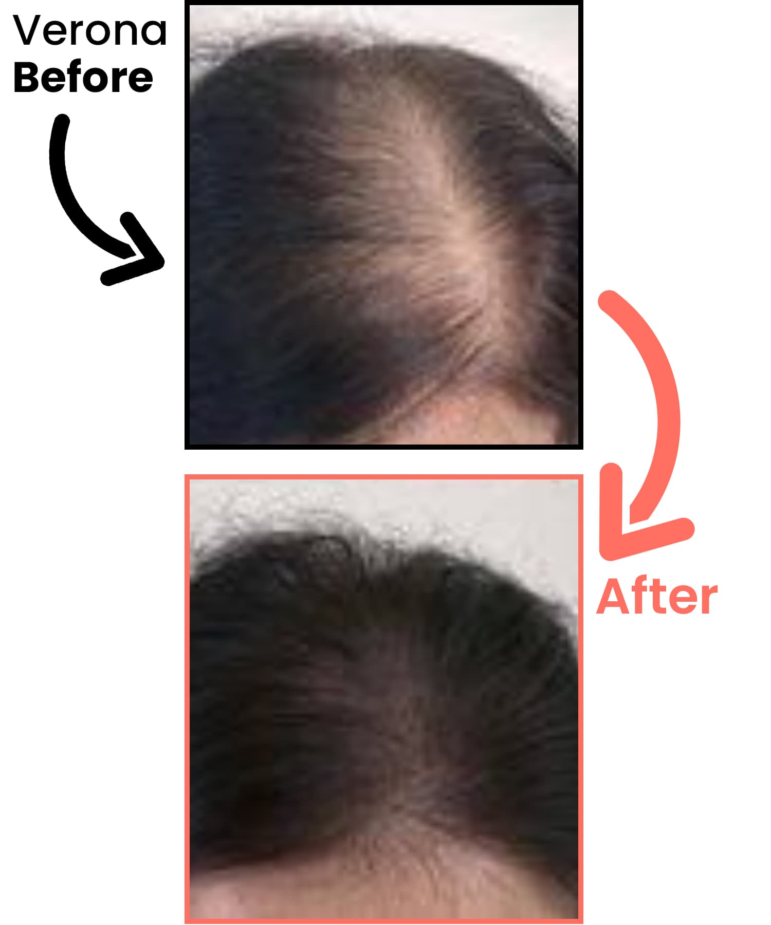 before-after-neu-verona